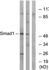 AP39026PU-N - SMAD1