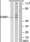 AP39027PU-N - DAB1