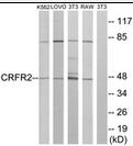 AP39031PU-N - CRHR2