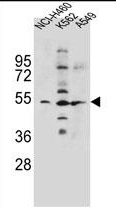 AP39032PU-N - SLC36A1 / PAT1