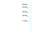 AP42010PU-N - MIXL1