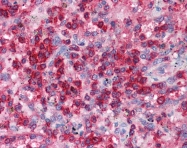 AP42040PU-N - Vacuolar-sorting protein SNF8