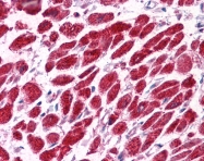 AP42040PU-N - Vacuolar-sorting protein SNF8