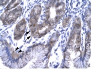 AP42040PU-N - Vacuolar-sorting protein SNF8