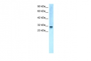 AP42040PU-N - Vacuolar-sorting protein SNF8