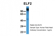 AP42047PU-N - ELF2 / NERF