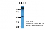 AP42047PU-N - ELF2 / NERF
