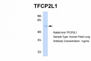 AP42072PU-N - TFCP2L1
