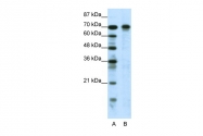 AP42127PU-N - HIC1 / ZBTB29