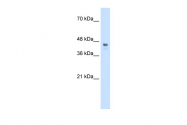 AP42131PU-N - HOXC10 / HOX3I