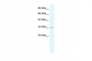 AP42287PU-N - Tristetraproline (TTP)