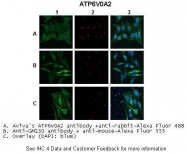AP43239PU-N - ATP6V0A2