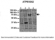 AP43239PU-N - ATP6V0A2