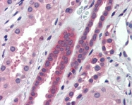 AP43239PU-N - ATP6V0A2