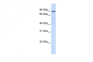 AP43239PU-N - ATP6V0A2