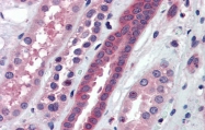 AP43239PU-N - ATP6V0A2