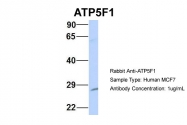 AP43551PU-N - ATP5F1