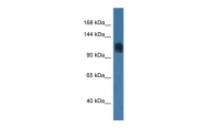 AP46008PU-N - RAG1 / RNF74