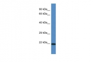 AP46073PU-N - TMEM147
