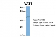 AP46098PU-N - VAT1