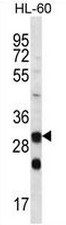 AP50698PU-N - Carbonic anhydrase 6