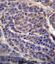 AP50698PU-N - Carbonic anhydrase 6