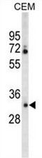 AP50699PU-N - Carbonic anhydrase 6