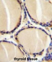 AP50713PU-N - CGRP / CALCA