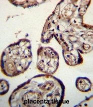 AP50717PU-N - Calumenin