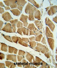 AP50723PU-N - Calpain-3