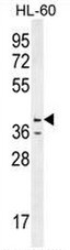 AP50732PU-N - Caspase-12