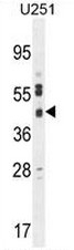 AP50737PU-N - C2orf18