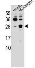 AP50743PU-N - Cerebellin-2