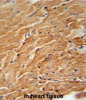AP50801PU-N - 6CKine / CCL21