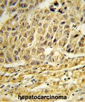 AP50808PU-N - CCNB1IP1