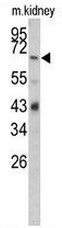 AP50876PU-N - Complement factor B
