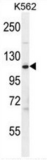 AP50878PU-N - Complement factor H (CFH)