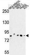 AP50902PU-N - Chondroitin sulfate synthase 2