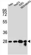 AP50904PU-N - Cholinephosphotransferase 1