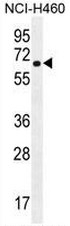 AP50909PU-N - Acetylcholine receptor delta subunit