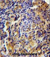 AP50933PU-N - C11orf73