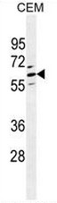 AP50963PU-N - CLEC4F