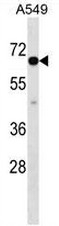 AP50974PU-N - CLPTM1-like protein