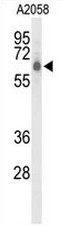 AP50975PU-N - CLPTM1-like protein