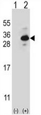 AP50978PU-N - Clathrin light chain B