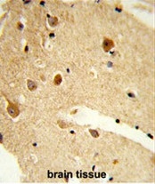 AP50983PU-N - CNDP1