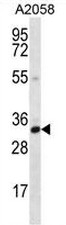 AP50987PU-N - Calponin-2