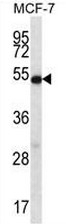 AP51008PU-N - Coilin