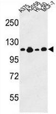 AP51010PU-N - Collagen type XVII alpha 1 chain