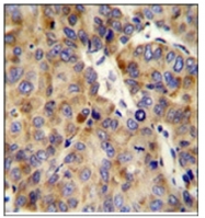AP51011PU-N - Collagen type XVIII alpha 1 chain